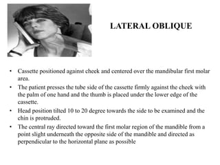 LATERAL OBLIQUE
• Cassette positioned against cheek and centered over the mandibular first molar
area.
• The patient presses the tube side of the cassette firmly against the cheek with
the palm of one hand and the thumb is placed under the lower edge of the
cassette.
• Head position tilted 10 to 20 degree towards the side to be examined and the
chin is protruded.
• The central ray directed toward the first molar region of the mandible from a
point slight underneath the opposite side of the mandible and directed as
perpendicular to the horizontal plane as possible
 