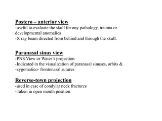 Postero – anterior view
-useful to evaluate the skull for any pathology, trauma or
developmental anomalies
-X ray beam directed from behind and through the skull.
Paranasal sinus view
-PNS View or Water’s projection
-Indicated in the visualization of paranasal sinuses, orbits &
-zygomatico- frontonasal sutures
Reverse-town projection
-used in case of condylar neck fractures
-Taken in open mouth position
 