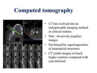 Computed tomography
• CT has evolved into an
indispensable imaging method
in clinical routine.
• Non –invasively acquires
images
• Not biased by superimposition
of anatomical structures
• CT yields images of much
higher contrast compared with
conventional.
 