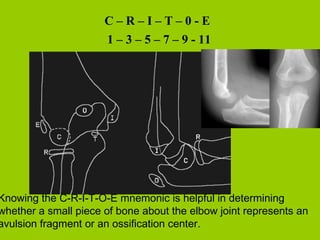 Pediatric radiology quizes chest and msk | PPT
