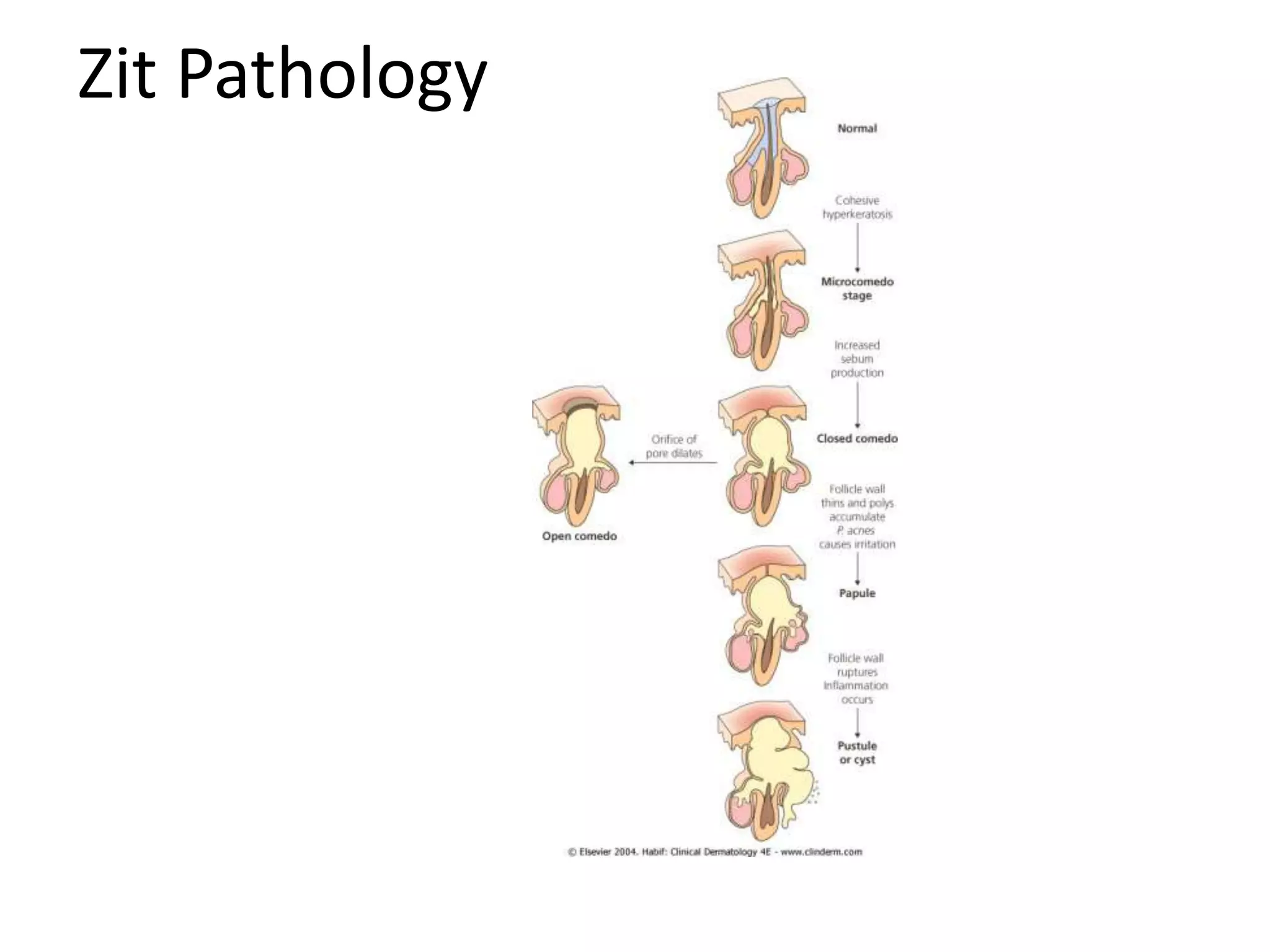 Pediatric rashes | PPTX