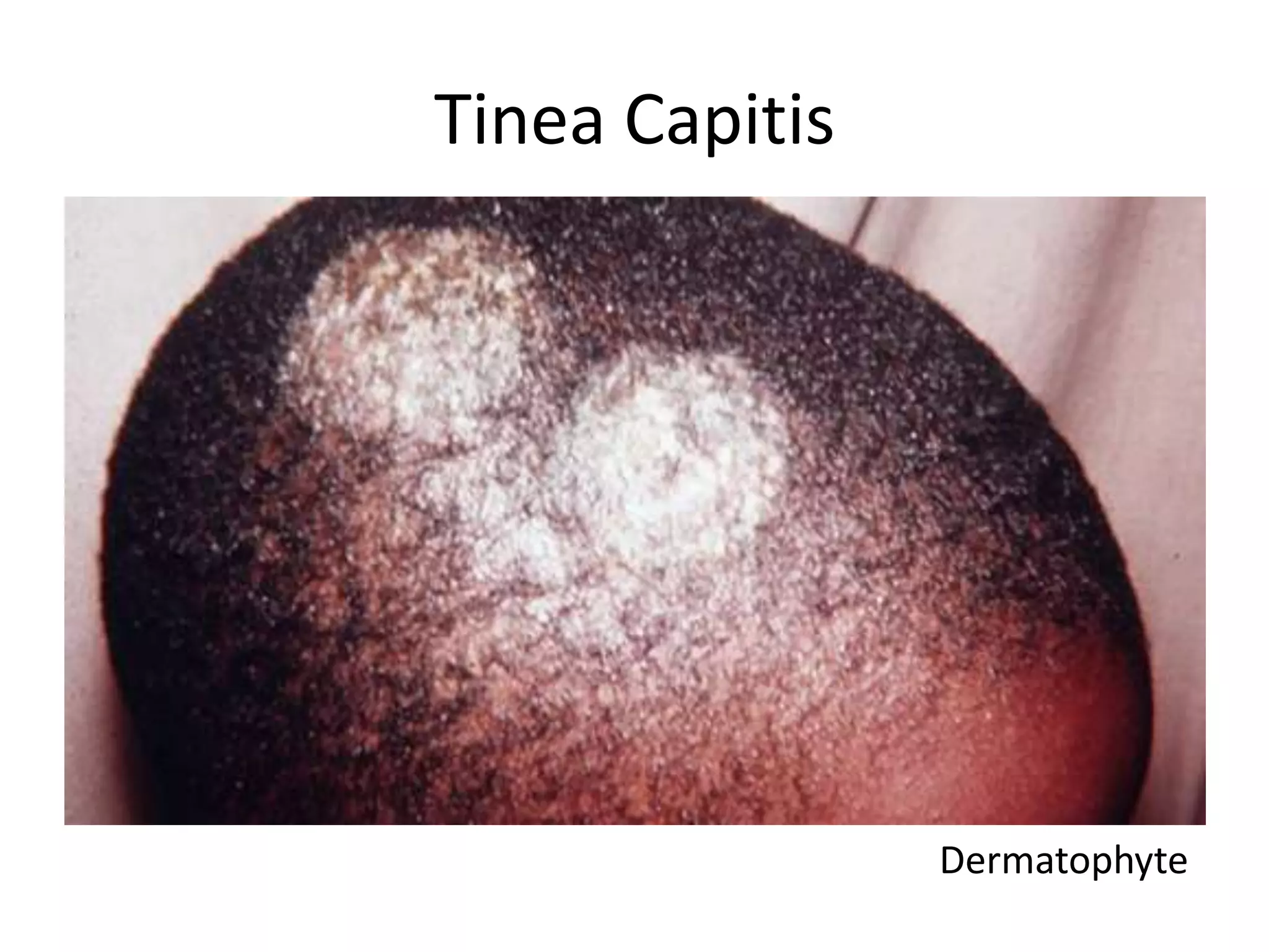 Pediatric rashes | PPTX