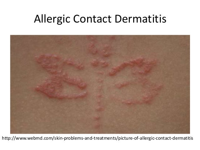 pediatric rashes