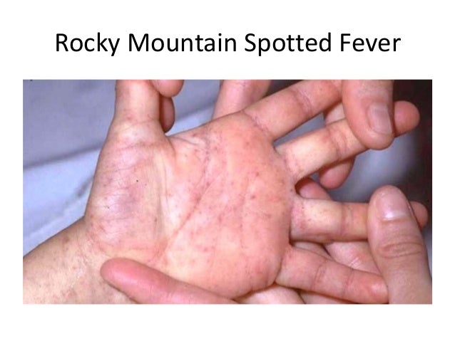 pediatric rashes