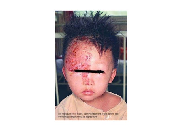 Pediatric Rashes.pptx