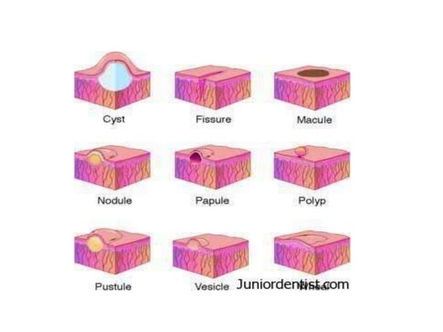 Pediatric Rashes.pptx