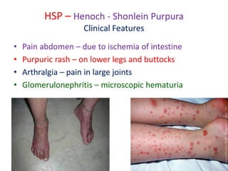 Hps Rash Pediatric rheumatology 2021 | PDF