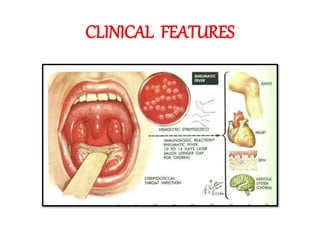 CLINICAL FEATURES
 