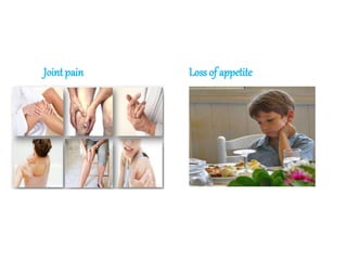 Joint pain Loss of appetite
 