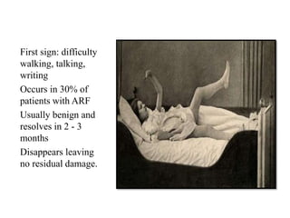First sign: difficulty
walking, talking,
writing
Occurs in 30% of
patients with ARF
Usually benign and
resolves in 2 - 3
months
Disappears leaving
no residual damage.
 