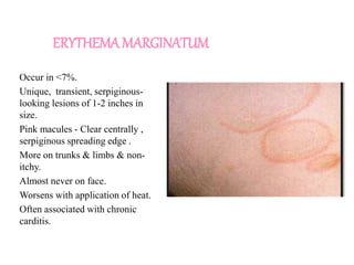 ERYTHEMA MARGINATUM
Occur in <7%.
Unique, transient, serpiginous-
looking lesions of 1-2 inches in
size.
Pink macules - Clear centrally ,
serpiginous spreading edge .
More on trunks & limbs & non-
itchy.
Almost never on face.
Worsens with application of heat.
Often associated with chronic
carditis.
 