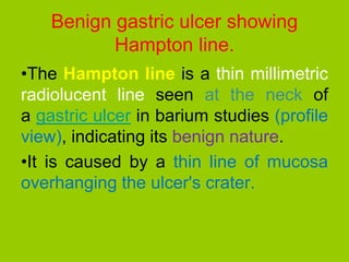 Hampton Line Pediatrics, Barium and Urological contrast technique Revision cases.pdf