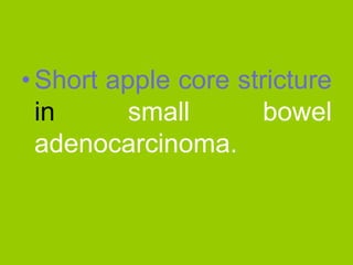 Pediatrics, Barium and Urological contrast technique Revision cases.pdf
