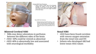 Pediatrics Hemodynamic monitoring in ICU.pptx