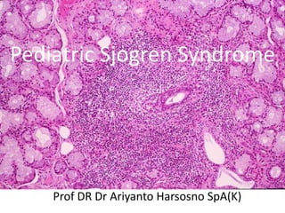 Pediatric Sjogren Syndrome
Prof DR Dr Ariyanto Harsosno SpA(K)
 