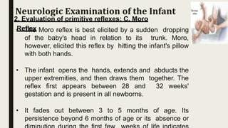 2. Evaluation of primitive reflexes: C. Moro
Reflex
• The Moro reflex is best elicited by a sudden dropping
of the baby's head in relation to its trunk. Moro,
however, elicited this reflex by hitting the infant's pillow
with both hands.
• The infant opens the hands, extends and abducts the
upper extremities, and then draws them together. The
reflex first appears between 28 and 32 weeks'
gestation and is present in all newborns.
• It fades out between 3 to 5 months of age. Its
persistence beyond 6 months of age or its absence or
Neurologic Examination of the Infant
 