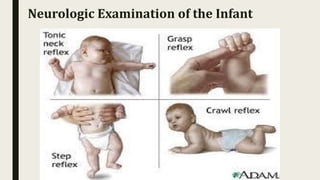 Neurologic Examination of the Infant
 