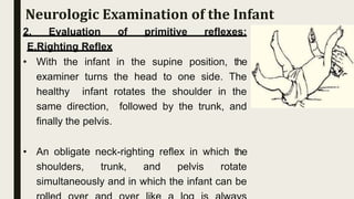 2. Evaluation of primitive reflexes:
E.Righting Reflex
• With the infant in the supine position, the
examiner turns the head to one side. The
healthy infant rotates the shoulder in the
same direction, followed by the trunk, and
finally the pelvis.
• An obligate neck-righting reflex in which the
shoulders, trunk, and pelvis rotate
simultaneously and in which the infant can be
Neurologic Examination of the Infant
 