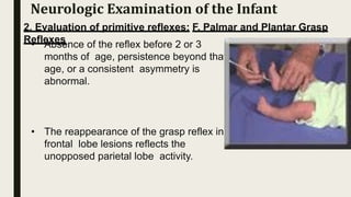 2. Evaluation of primitive reflexes: F. Palmar and Plantar Grasp
Reflexes
• Absence of the reflex before 2 or 3
months of age, persistence beyond that
age, or a consistent asymmetry is
abnormal.
• The reappearance of the grasp reflex in
frontal lobe lesions reflects the
unopposed parietal lobe activity.
Neurologic Examination of the Infant
 