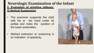 2. Evaluation of primitive reflexes:
G.Vertical Suspension
• The examiner suspends the child
with his or her hand under its
axillae and notes the position of
the lower extremities.
• Marked extension or scissoring is
an indication of spasticity.
Neurologic Examination of the Infant
 