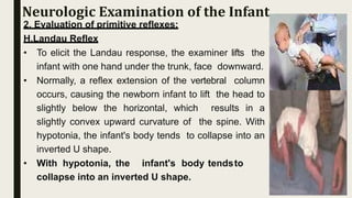 2. Evaluation of primitive reflexes:
H.Landau Reflex
• To elicit the Landau response, the examiner lifts the
infant with one hand under the trunk, face downward.
• Normally, a reflex extension of the vertebral column
occurs, causing the newborn infant to lift the head to
slightly below the horizontal, which results in a
slightly convex upward curvature of the spine. With
hypotonia, the infant's body tends to collapse into an
inverted U shape.
• With hypotonia, the infant's body tendsto
collapse into an inverted U shape.
Neurologic Examination of the Infant
 