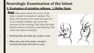 2. Evaluation of primitive reflexes: L.Reflex Suck,
Root
• This reflex starts when the corner of the
baby's mouth is stroked or touched. The
baby will turn his or her head and open his
or her mouth to follow and root in the
direction of the stroking. This helps the baby
find the breast or bottle to start feeding. This
reflex lasts about 4 months.
• Rooting helps the baby get ready to suck.
• When the roof of the baby's mouth is
touched, the baby will start to suck.
Neurologic Examination of the Infant
 