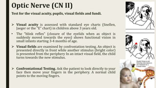 Optic Nerve (CN II)
Test for the visual acuity, pupils, visual fields and fundi.
 Visual acuity is assessed with standard eye charts (Snellen,
Jaeger or the "E" chart) in children above 3 years old.
• The "blink reflex" (closure of the eyelids when as object is
suddenly moved towards the eyes) shows functional vision in
small infants starting 3-4 months of age.
 Visual fields are examined by confrontation testing. An object is
presented directly in front while another stimulus (bright color)
is presented from the periphery In an intact visual field, the child
turns towards the new stimulus.
 Confrontational Testing. Ask the patient to look directly to your
face then move your fingers in the periphery. A normal child
points to the moving fingers.
 