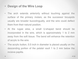 • Design of the Wire Loop
• The arch extends anteriorly without touching against the
surface of the primary molars; as the successor bicuspids
usually are broader buccolingually, and the wire could deflect
them from their natural position.
• At the rugae area, a small U-shaped bend should be
incorporated in the wire, which is approximately 1 to 2 mm
away from the soft tissue. The bend will enhance the retention
of acrylic to the wire
• The acrylic button, 0.5 inch in diameter is placed usually on the
descending portion of the palatal vault 1 to 2 mm below the
incisive papilla.
102
 