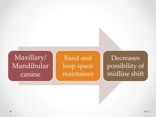 Maxillary/
Mandibular
canine
Band and
loop space
maintainer
Decreases
possibility of
midline shift
17
 