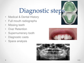 Diagnostic steps
• Medical & Dental History
• Full mouth radiographs
• Missing teeth
• Over Retention
• Supernumerary tooth
• Diagnostic casts
• Space analysis
22
 