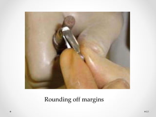 61
Rounding off margins
 