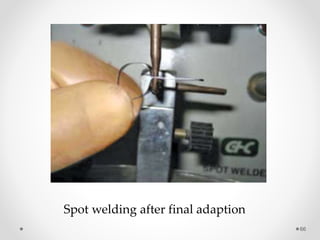 66
Spot welding after final adaption
 