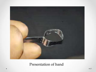 67
Presentation of band
 