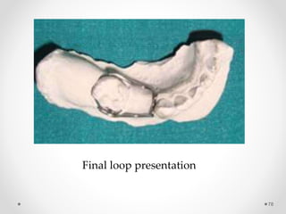 78
Final loop presentation
 