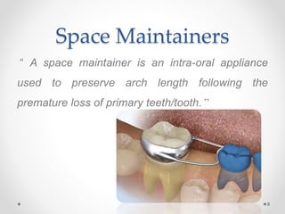 Space Maintainers
“ A space maintainer is an intra-oral appliance
used to preserve arch length following the
premature loss of primary teeth/tooth. ”
8
 