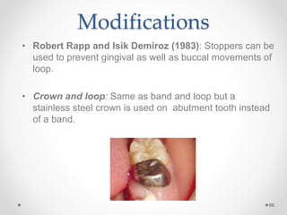 Modifications
• Robert Rapp and Isik Demiroz (1983): Stoppers can be
used to prevent gingival as well as buccal movements of
loop.
• Crown and loop: Same as band and loop but a
stainless steel crown is used on abutment tooth instead
of a band.
86
 