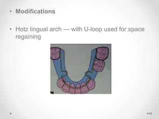 • Modifications
• Hotz lingual arch — with U-loop used for space
regaining
98
 