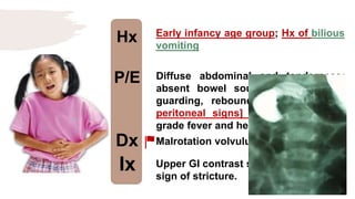 Hx
P/E
Dx
Ix
Early infancy age group; Hx of bilious
vomiting
Diffuse abdominal and tenderness;
absent bowel sounds [obstruction],
guarding, rebound tenderness [+ve
peritoneal signs] associated w/ low
grade fever and hematochezia.
Malrotation volvulus
Upper GI contrast study; bird beak
sign of stricture.
 
