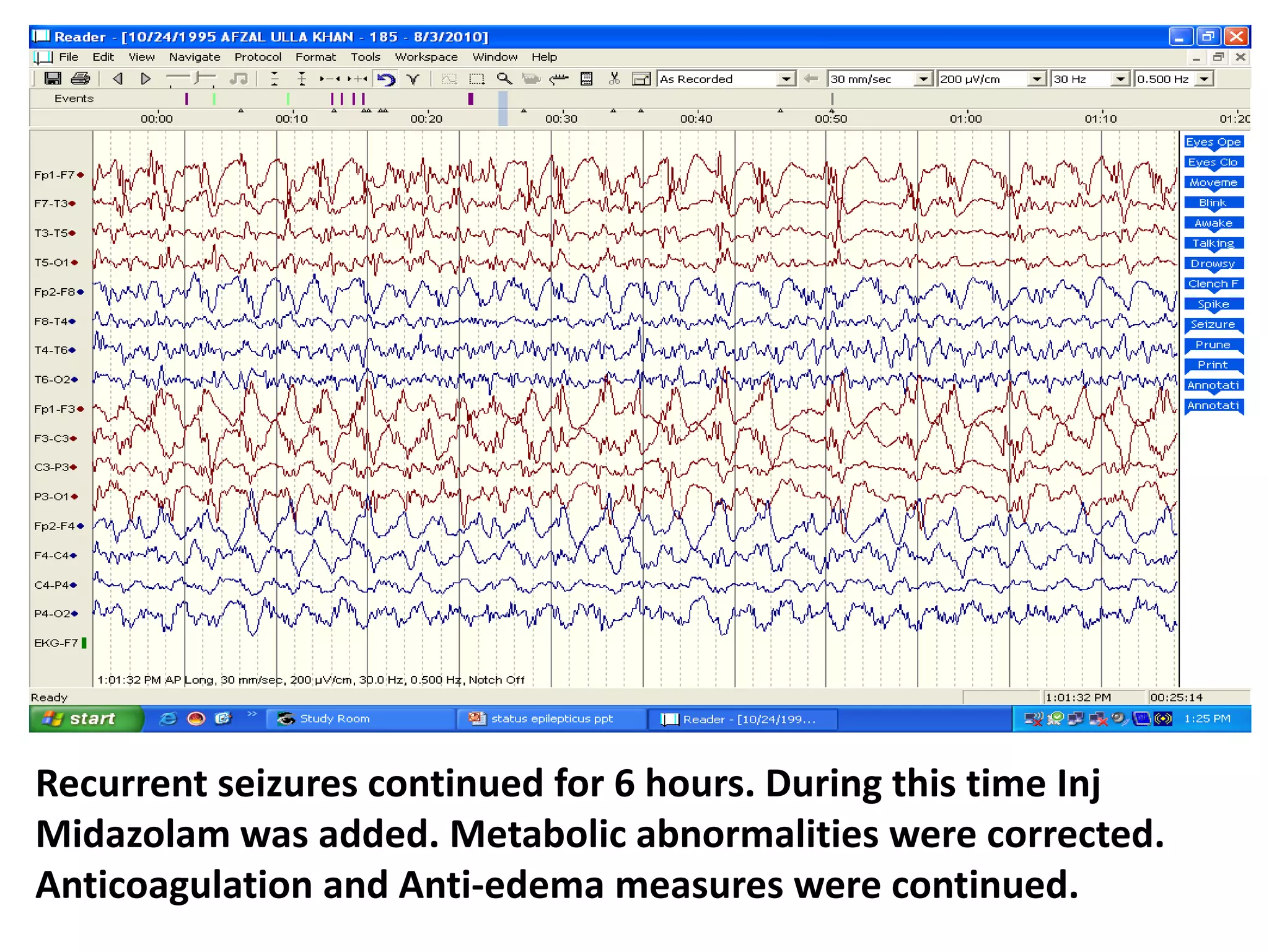 Recurrent seizures continued for 6 hours. During this time Inj
Midazolam was added. Metabolic abnormalities were corrected.
Anticoagulation and Anti-edema measures were continued.
 