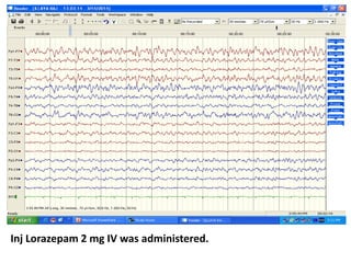 Inj Lorazepam 2 mg IV was administered.
 