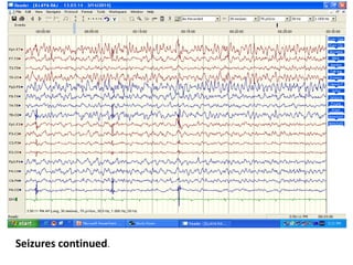 Seizures continued.
 