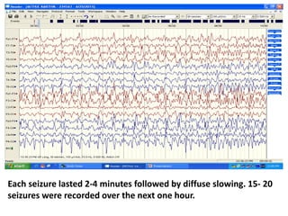 Each seizure lasted 2-4 minutes followed by diffuse slowing. 15- 20
seizures were recorded over the next one hour.
 