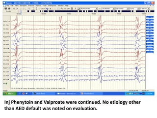 Inj Phenytoin and Valproate were continued. No etiology other
than AED default was noted on evaluation.
 