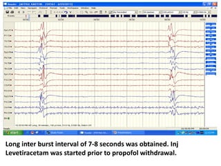 Long inter burst interval of 7-8 seconds was obtained. Inj
Levetiracetam was started prior to propofol withdrawal.
 