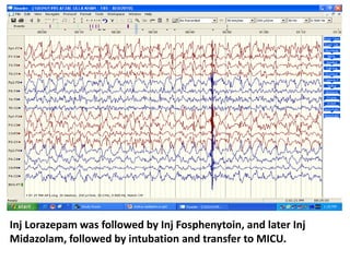 Inj Lorazepam was followed by Inj Fosphenytoin, and later Inj
Midazolam, followed by intubation and transfer to MICU.
 