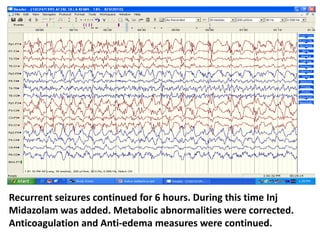 Recurrent seizures continued for 6 hours. During this time Inj
Midazolam was added. Metabolic abnormalities were corrected.
Anticoagulation and Anti-edema measures were continued.
 