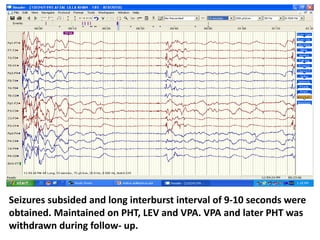 Seizures subsided and long interburst interval of 9-10 seconds were
obtained. Maintained on PHT, LEV and VPA. VPA and later PHT was
withdrawn during follow- up.
 