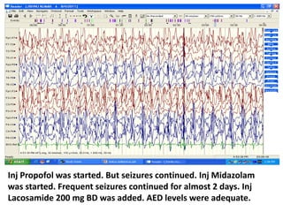 Inj Propofol was started. But seizures continued. Inj Midazolam
was started. Frequent seizures continued for almost 2 days. Inj
Lacosamide 200 mg BD was added. AED levels were adequate.
 