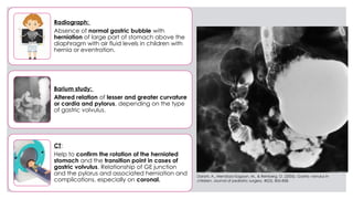 Pediatric Stomach and Duodenal Imaging copy.pptx