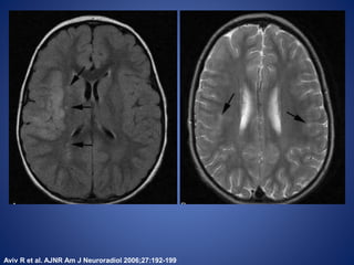 Aviv R et al. AJNR Am J Neuroradiol 2006;27:192-199
 